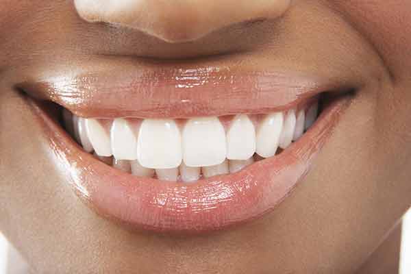 white-teeth